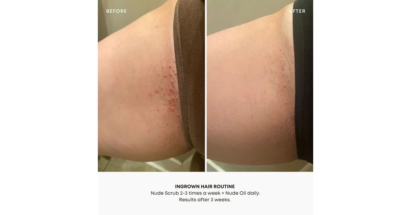 Bushbalm Nude Oil Ingrown Hair (30ml)