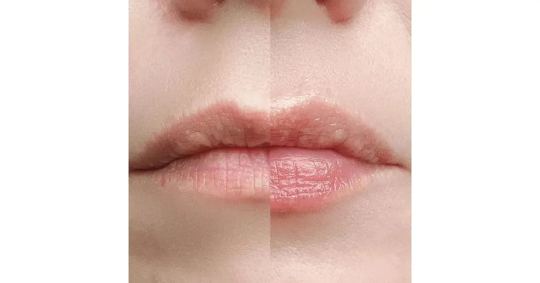 ADOREYES PepChat Biometric Complex Lip Serum (10ml)