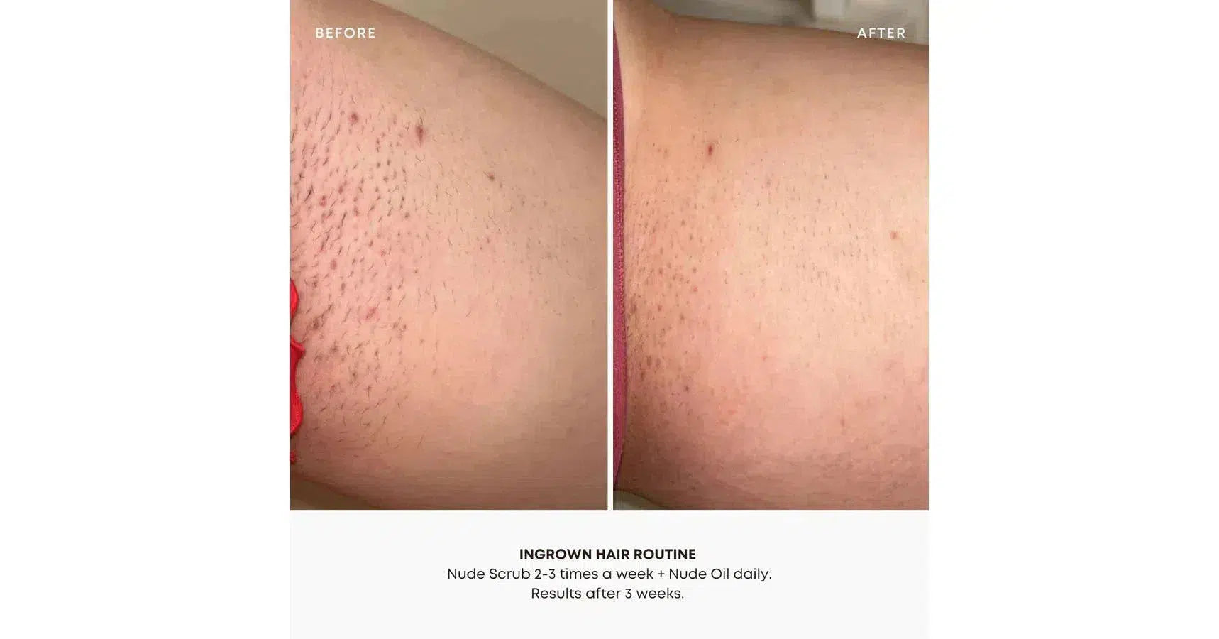 Bushbalm Nude Exfoliating Scrub Ingrown Hair (8oz/236ml)