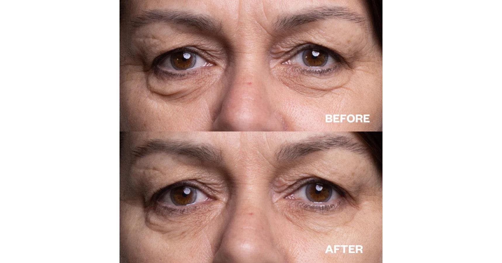 Wrinkles Schminkles Eye Patches - Reusable (3 pairs per pack)