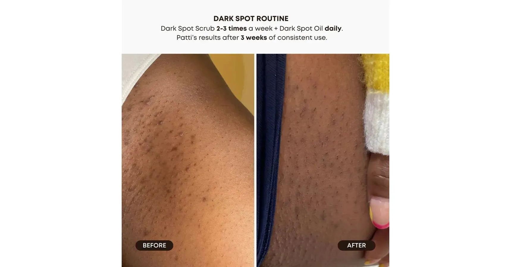 Bushbalm Lavender Lemon Exfoliating Scrub Dark Spot (8oz/236ml)