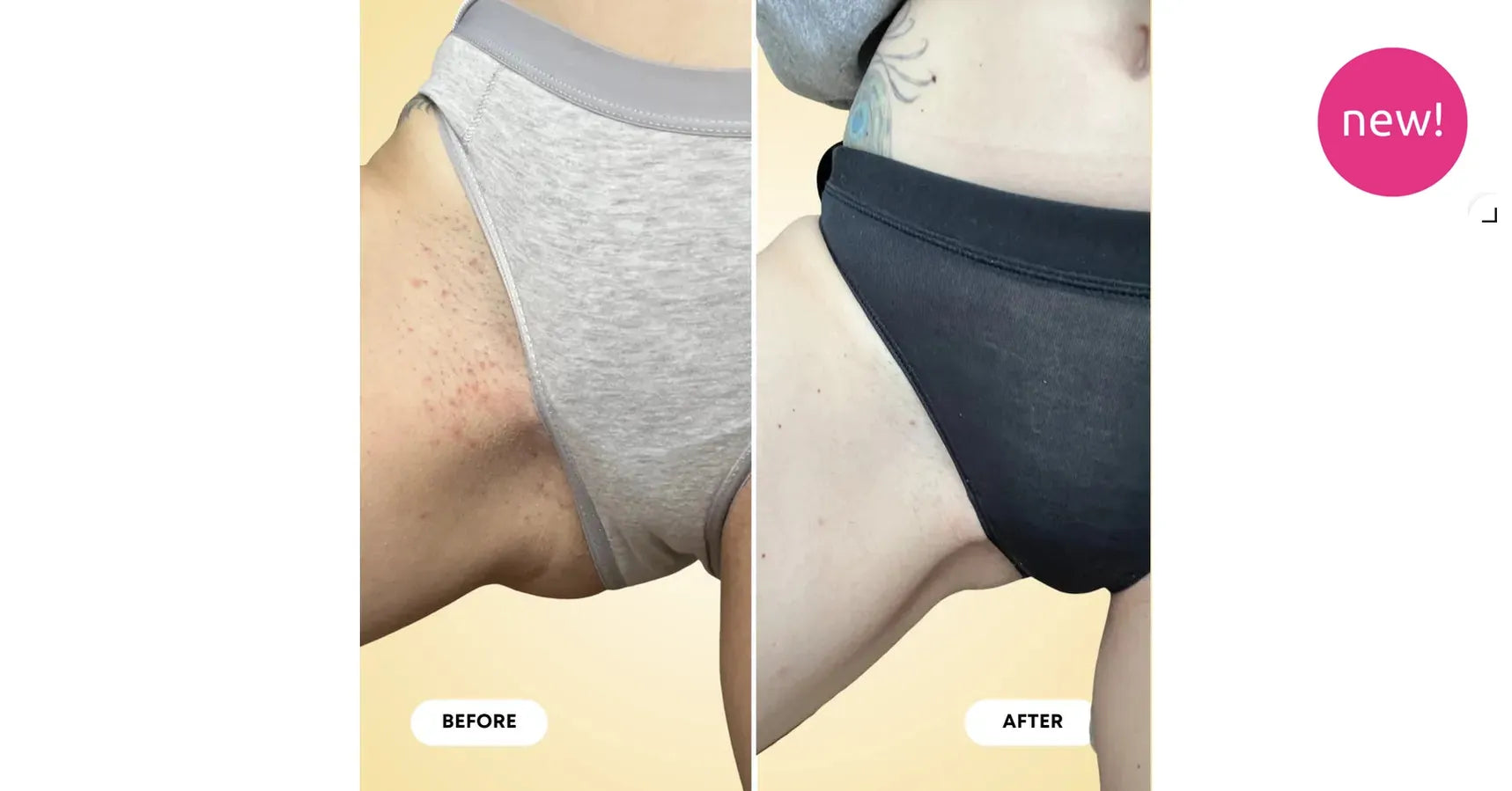 Bushbalm Milk and Honey Exfoliating Scrub Ingrown Hair (8oz/236ml)