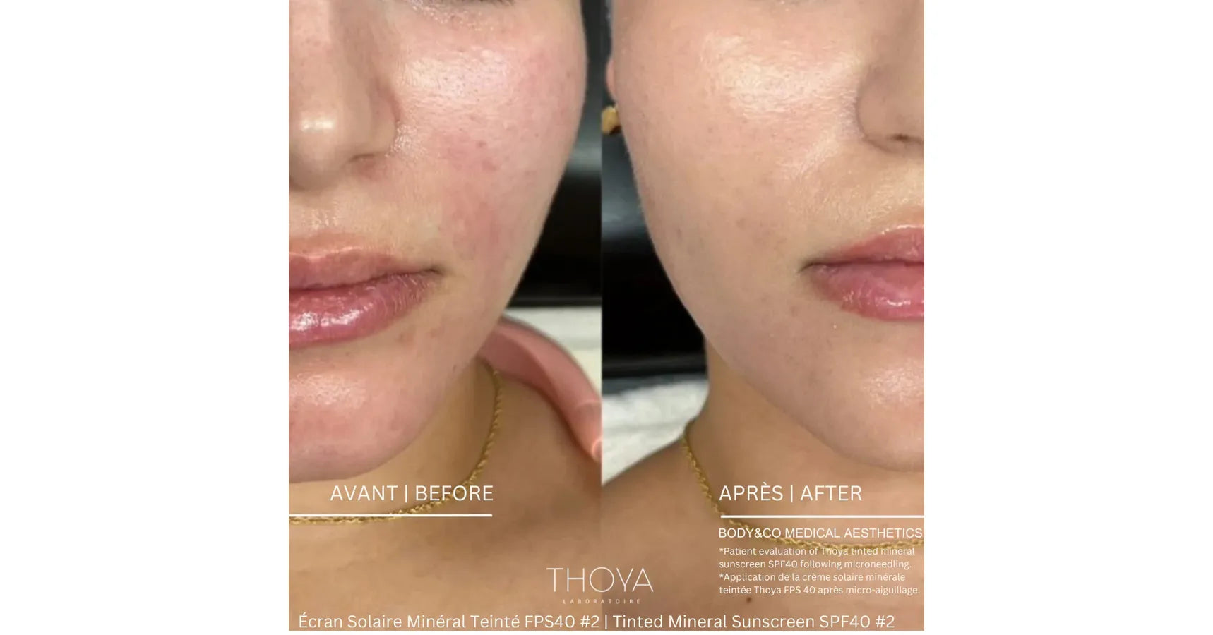 THOYA Tinted Mineral Sunscreen SPF40 #2 Rose Ivory (50ml)
