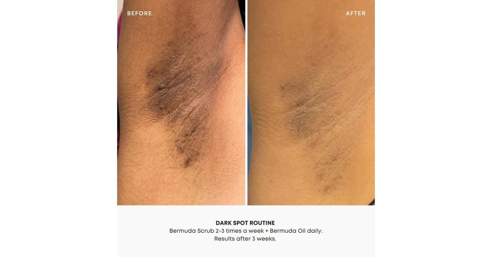 Bushbalm Bermuda Oil Dark Spot