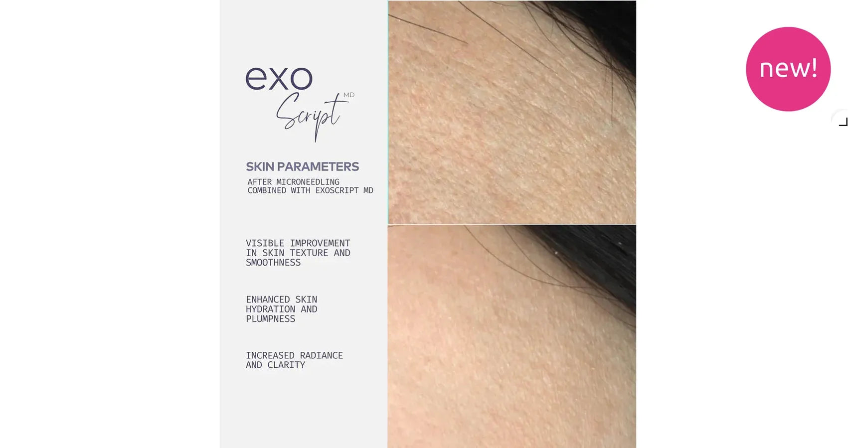 ADOREYES ExoScript MD™ Biomimetic Renewal Face Serum (20 ml)