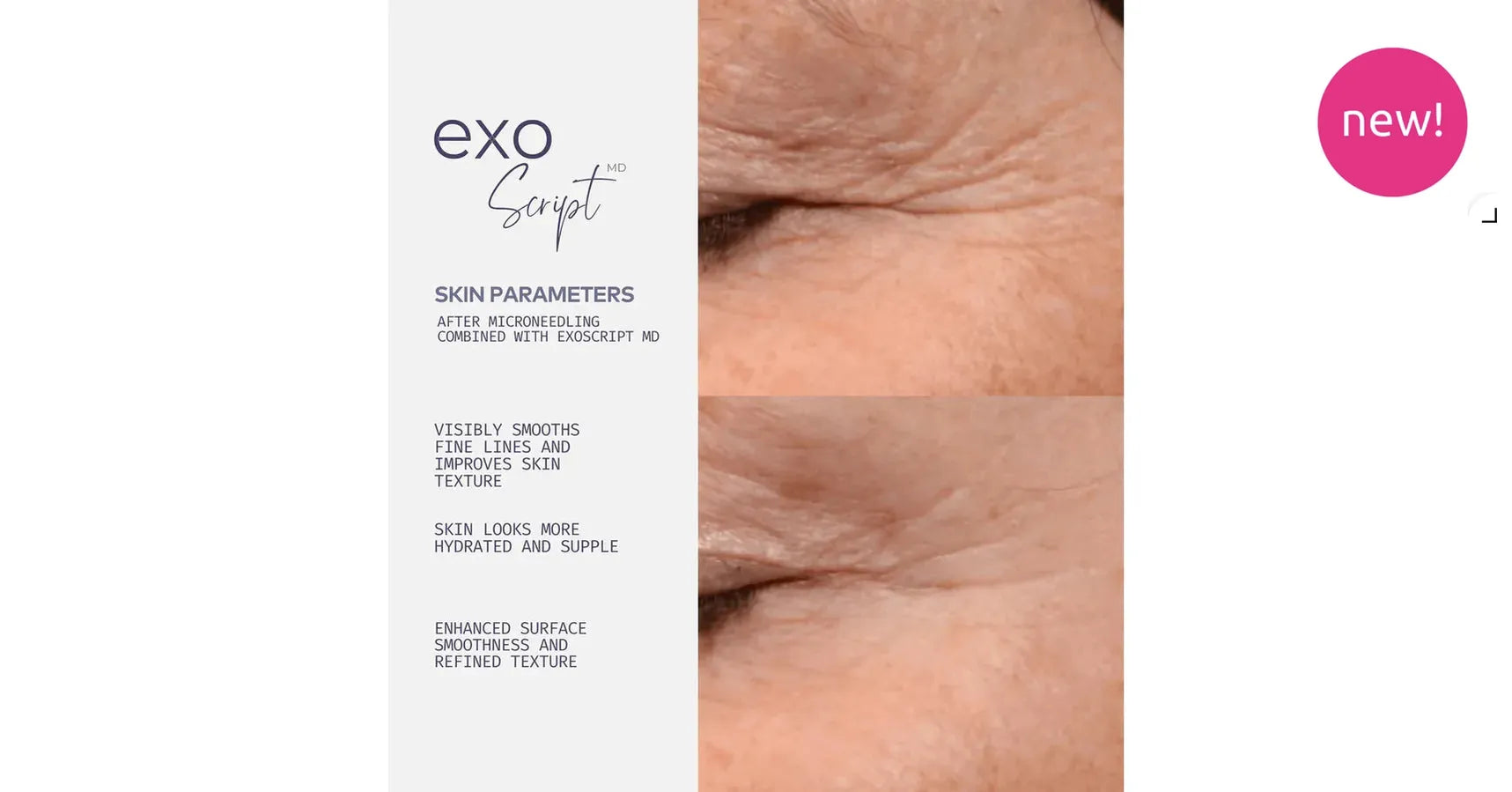 ADOREYES ExoScript MD™ Biomimetic Renewal Face Serum (20 ml)