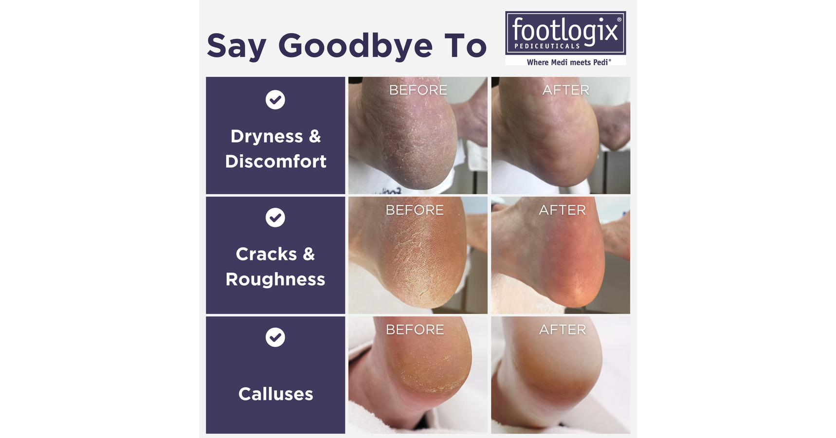 Footlogix Ultimate “At Home” Foot Care Combo