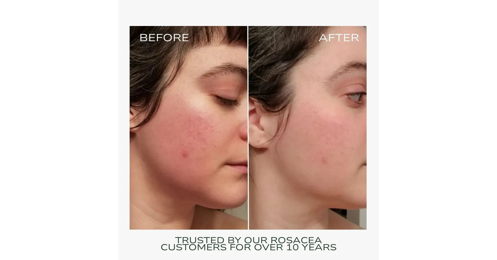 Fitglow Redness Rescue Cream (RRC) (30ml)