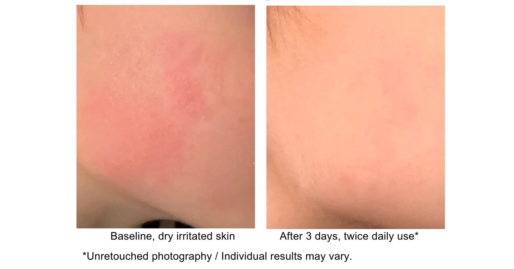 THOYA Nutrient Skin Care Oil (50ml)