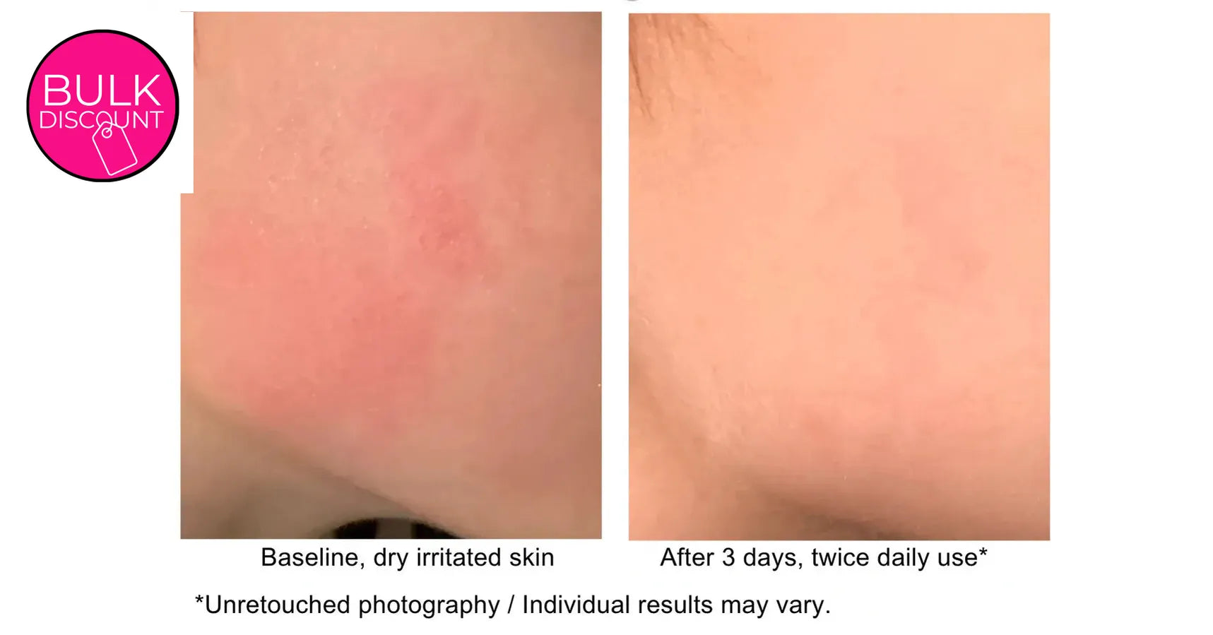 THOYA Nutrient Skin Care Oil (50ml)