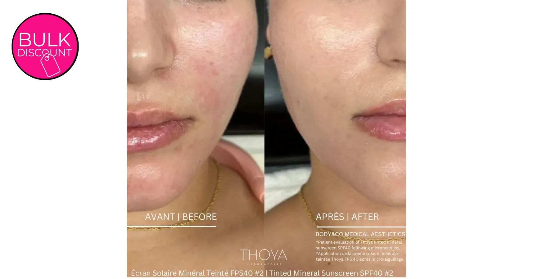 THOYA Tinted Mineral Sunscreen SPF40 #2 Rose Ivory (50ml)