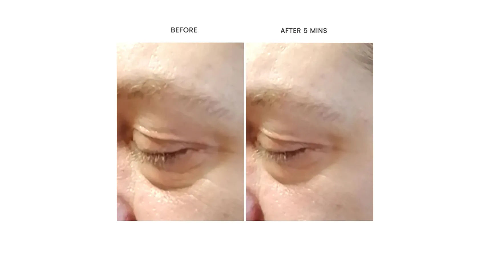 Hylunia Intensive Repair Eye Cream (0.5oz / 15ml)