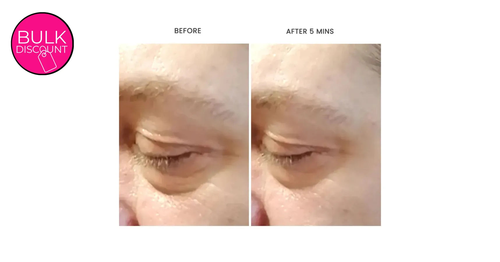 Hylunia Intensive Repair Eye Cream (0.5oz / 15ml)