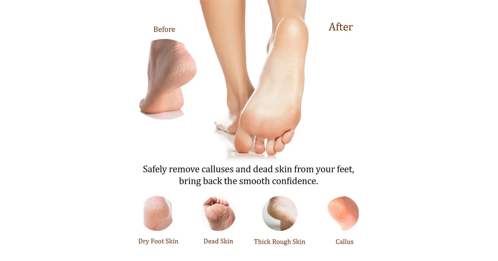 La Palm Super Callus Remover - Spearmint (1Gal)