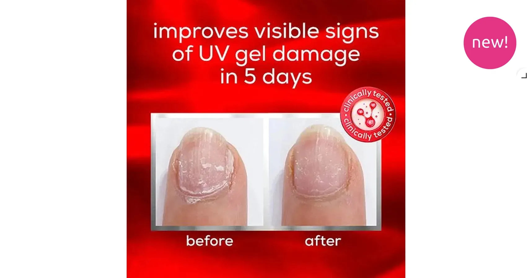 essie treatment - to the rescue nail repair (13.5ml)